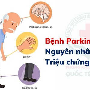 Bệnh Parkinson là gì?
